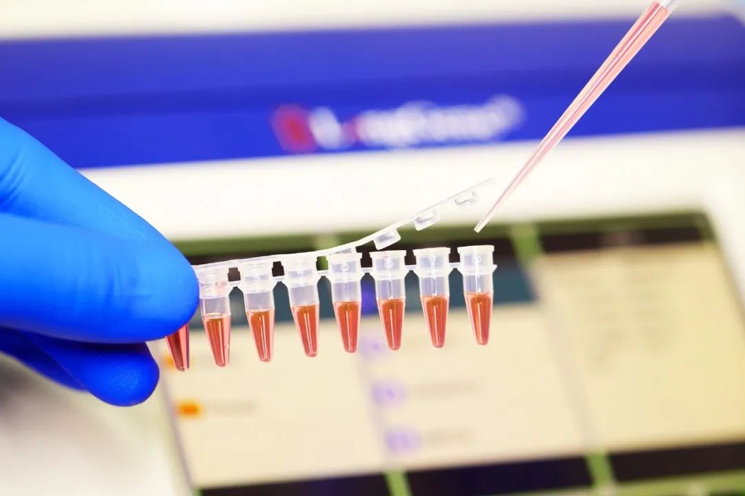 څنګه د PCR/qPCR مصرفي توکي غوره کړئ؟